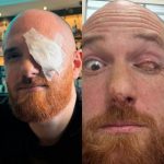 🇫🇷 France : Un homme de 35 ans perd son œil gauche lors d&rsquo;une opération des sinus de routine à la clinique Paris-Bercy ! La chirurgienne confond son globe oculaire avec un polype et l&rsquo;aspire comme un raisin, transformant l&rsquo;intervention en drame avec hémorragie majeure. Une procédure judiciaire enquête sur ce scandale médical qui révèle les risques du système de santé français.