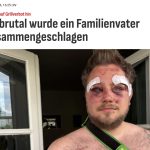 🇩🇪 Allemagne : À Berlin, Steven K. (36) rappelle le règlement anti-grill dans la cour : une famille roumaine riposte par gaz poivré et tabassage. Épaule démise, nez cassé. La police arrive après la fuite des agresseurs. Les Allemands doivent-ils encore courber l’échine chez eux ?