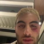 🇪🇸 Espagne : À Barcelone, un DJ tabassé par 5-6 Marocains pour sa montre se heurte à 4 voitures de police qui n’interviennent pas, un agent l’insulte. L’hôpital tarde 10 minutes à ouvrir malgré sa détresse respiratoire. L’Espagne de 2026 récolte les fruits de l’immigration incontrôlée.